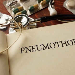 Ano ang Pneumothorax? Mga Importanteng Impormasyon at Mga Uri ng Paggamot Nito